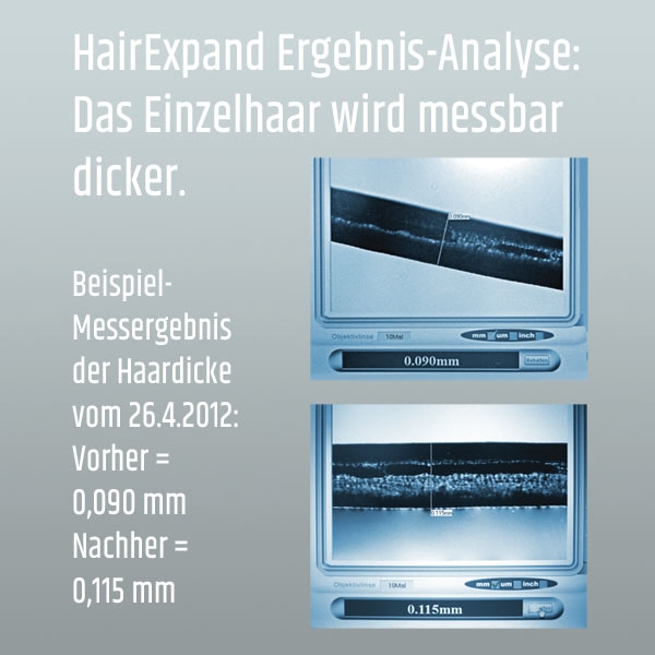 hairexpand haarverdicker test